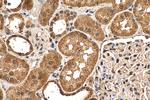 CHERP Antibody in Immunohistochemistry (Paraffin) (IHC (P))