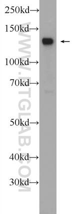 CHERP Antibody in Western Blot (WB)