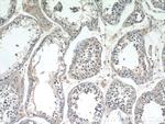 CYTSA Antibody in Immunohistochemistry (Paraffin) (IHC (P))