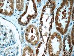 FAM20C Antibody in Immunohistochemistry (Paraffin) (IHC (P))