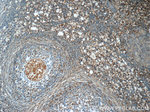 FAM20C Antibody in Immunohistochemistry (Paraffin) (IHC (P))