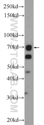 FAM20C Antibody in Western Blot (WB)
