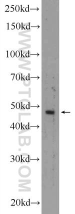 KRT40 Antibody in Western Blot (WB)