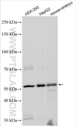 FOXN3 Antibody in Western Blot (WB)