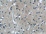 MGC39372 Antibody in Immunohistochemistry (Paraffin) (IHC (P))