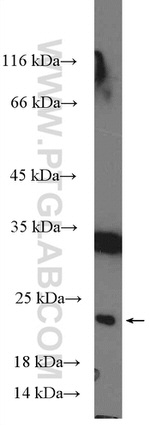 C13orf27/TEX30 Antibody in Western Blot (WB)