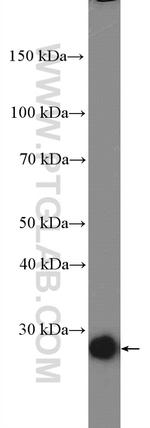C13orf27/TEX30 Antibody in Western Blot (WB)