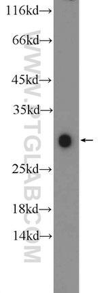 ZNF740 Antibody in Western Blot (WB)