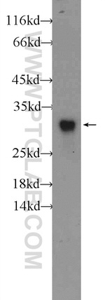 ZNF740 Antibody in Western Blot (WB)