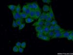 G6PD Antibody in Immunocytochemistry (ICC/IF)