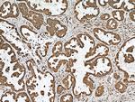 G6PD Antibody in Immunohistochemistry (Paraffin) (IHC (P))