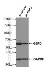 G6PD Antibody in Western Blot (WB)