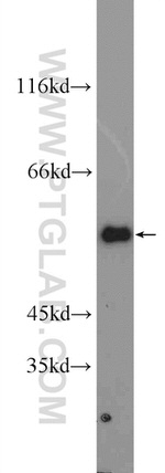 G6PD Antibody in Western Blot (WB)