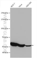 G6PD Antibody in Western Blot (WB)