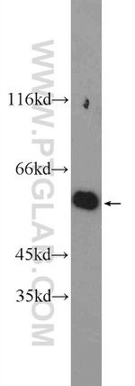 G6PD Antibody in Western Blot (WB)