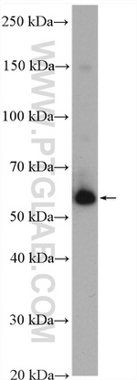 G6PD Antibody in Western Blot (WB)