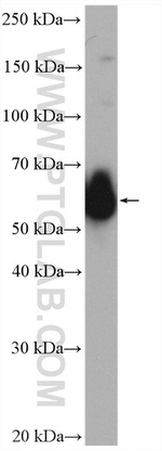 G6PD Antibody in Western Blot (WB)