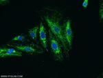KIAA0907 Antibody in Immunocytochemistry (ICC/IF)