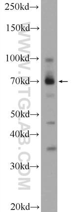 ZBTB44 Antibody in Western Blot (WB)