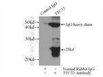 TTC32 Antibody in Immunoprecipitation (IP)