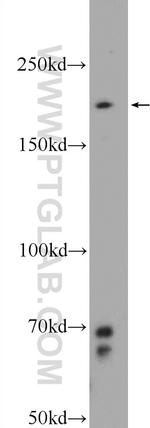 PPRC1 Antibody in Western Blot (WB)