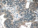 OTUD6B Antibody in Immunohistochemistry (Paraffin) (IHC (P))