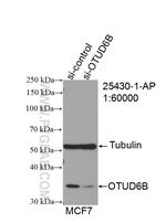 OTUD6B Antibody in Western Blot (WB)