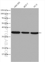 OTUD6B Antibody in Western Blot (WB)