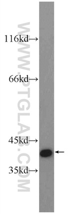 OTUD6B Antibody in Western Blot (WB)