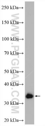 OTUD6B Antibody in Western Blot (WB)