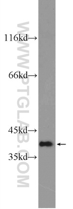 OTUD6B Antibody in Western Blot (WB)