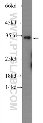 OTUD6B Antibody in Western Blot (WB)
