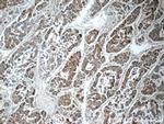 C1orf56 Antibody in Immunohistochemistry (Paraffin) (IHC (P))