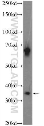 C1orf56 Antibody in Western Blot (WB)