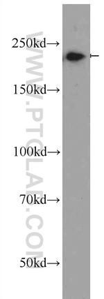 Envoplakin Antibody in Western Blot (WB)