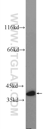TTC35 Antibody in Western Blot (WB)