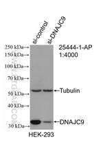 DNAJC9 Antibody in Western Blot (WB)