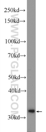 DNAJC9 Antibody in Western Blot (WB)