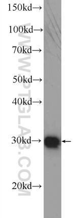 DNAJC9 Antibody in Western Blot (WB)