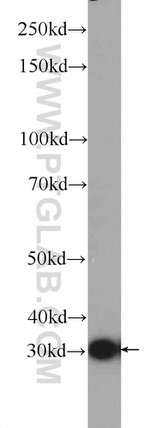 DNAJC9 Antibody in Western Blot (WB)