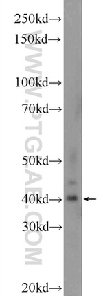 C15orf58 Antibody in Western Blot (WB)