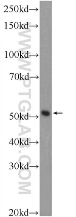 C15orf58 Antibody in Western Blot (WB)