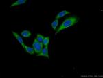 C15orf58 Antibody in Immunocytochemistry (ICC/IF)