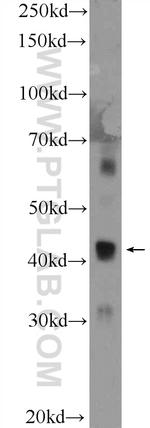 C15orf58 Antibody in Western Blot (WB)