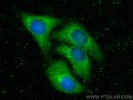 DCLK2 Antibody in Immunocytochemistry (ICC/IF)