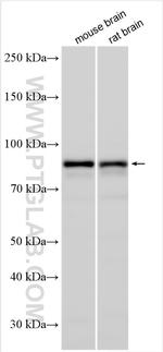 DCLK2 Antibody in Western Blot (WB)