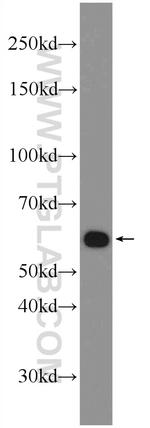 ZNF211 Antibody in Western Blot (WB)