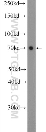 ZNF48 Antibody in Western Blot (WB)