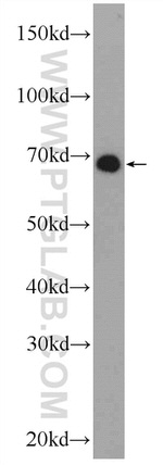 ZNF48 Antibody in Western Blot (WB)