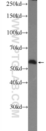 SAAL1 Antibody in Western Blot (WB)